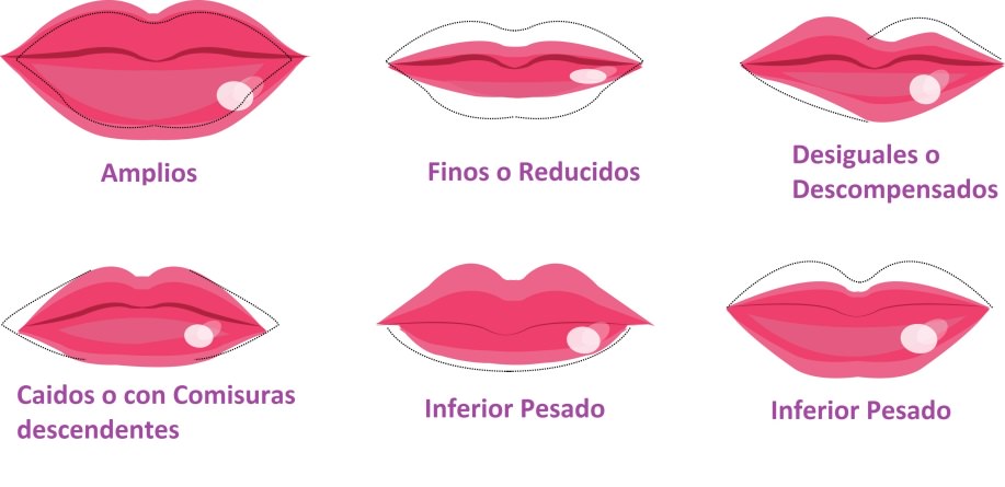 labios